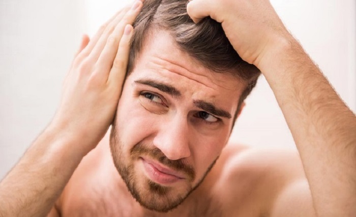 How Do Fitzroy Hair Loss Treatments Compare to Other Cities